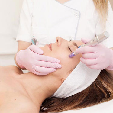 Microneedling mesotherapy